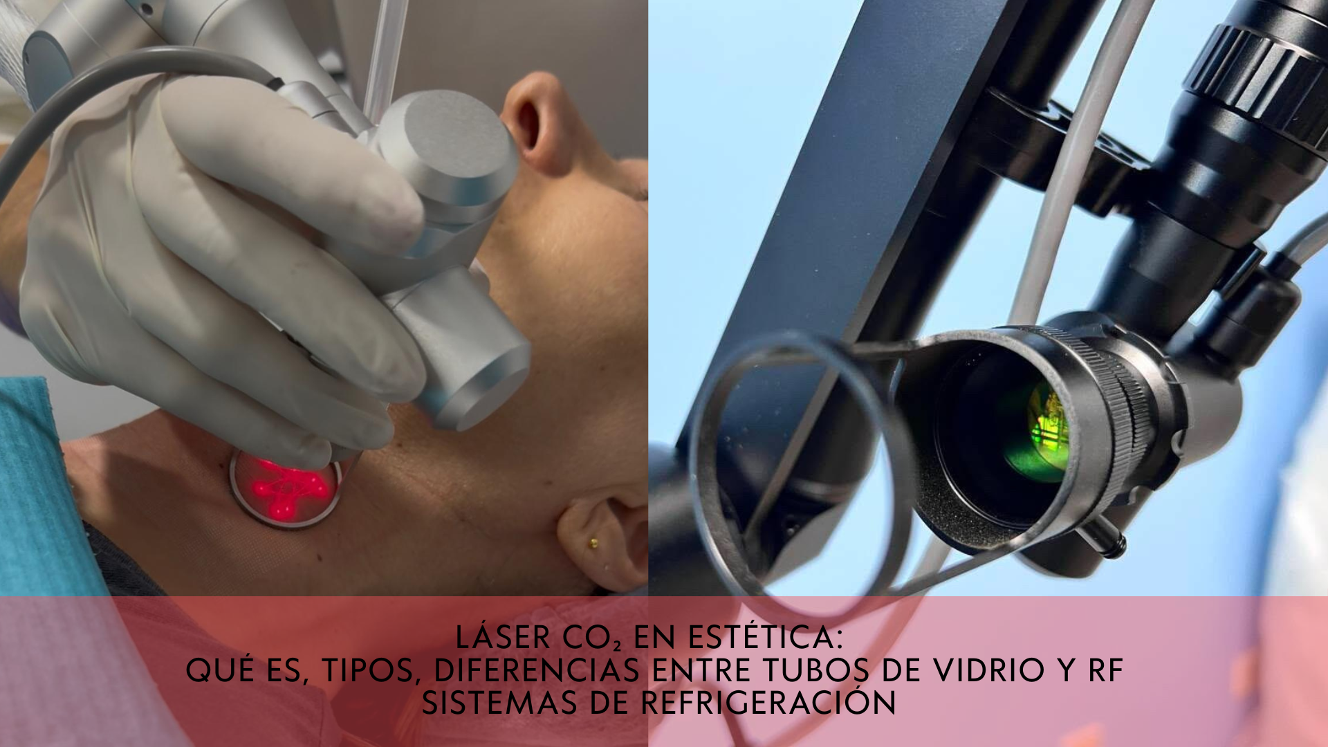 Láser CO₂ en estética