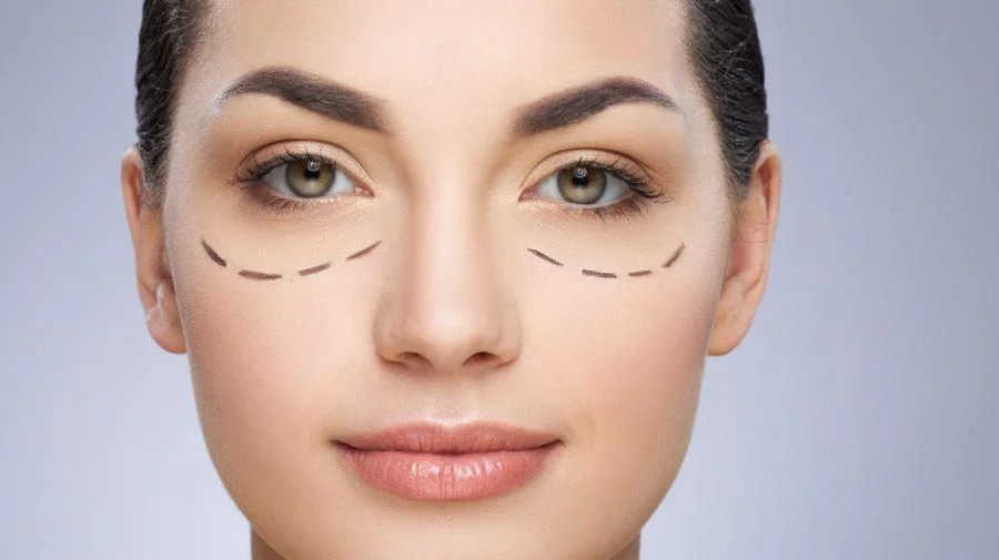 ¿Bolsas en los ojos resistentes?