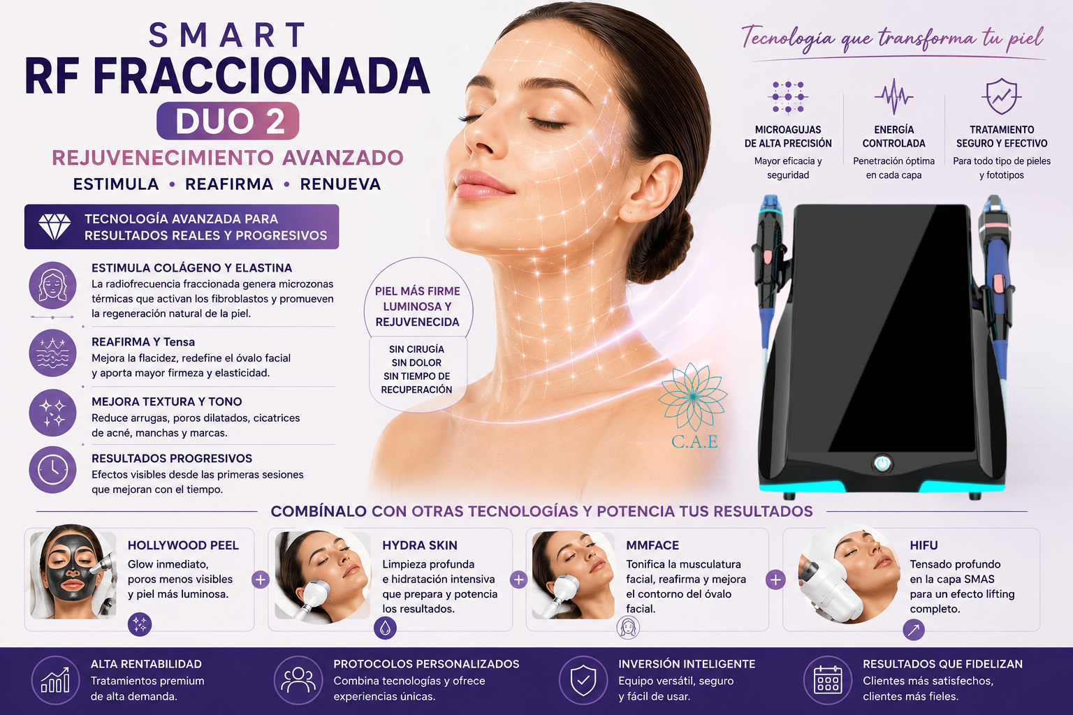 ✨ Ventajas de SMART RF FRACCIONADA