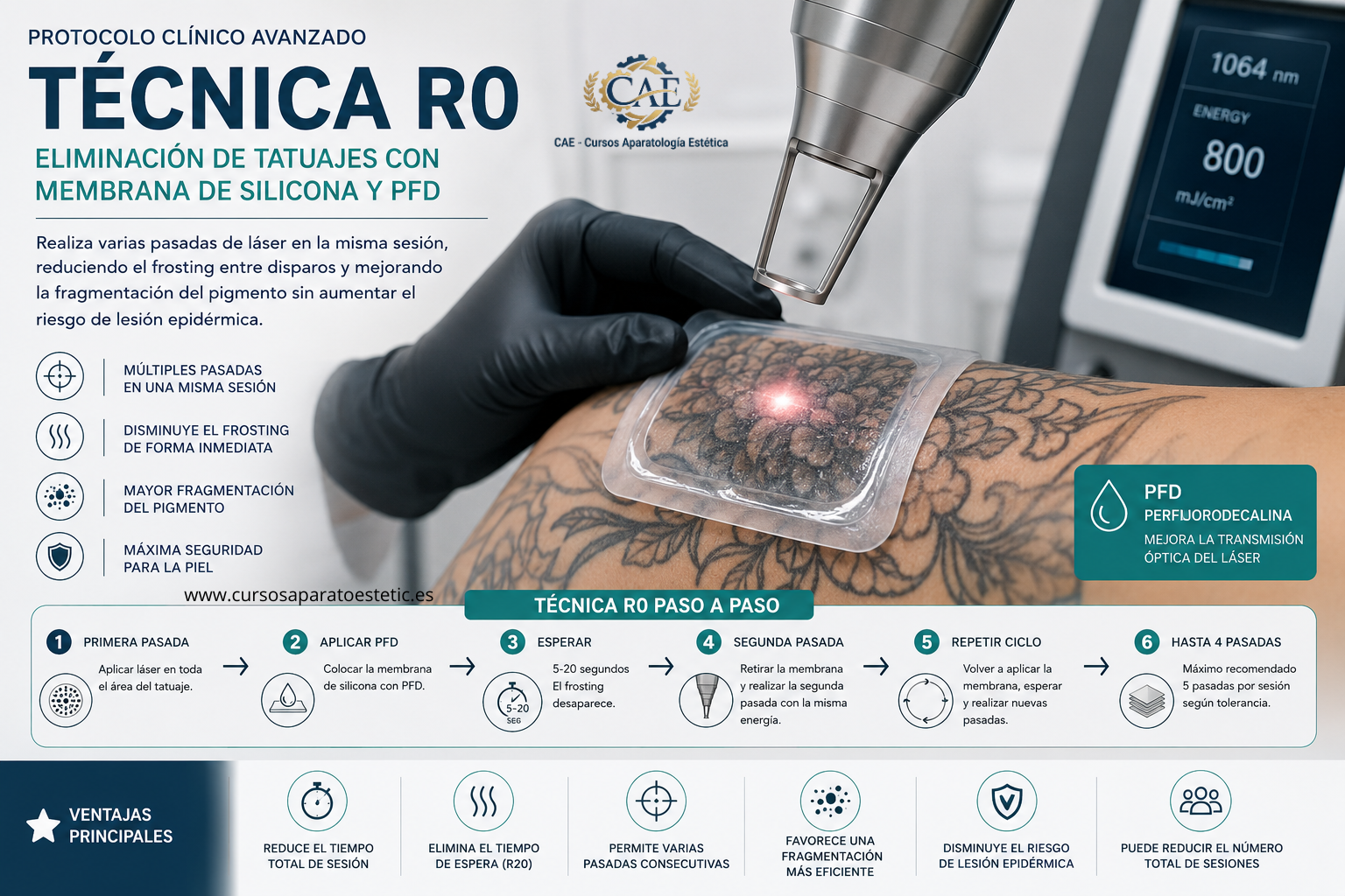 Protocolo R0 para eliminación de tatuajes con láser y PFD | Técnica avanzada estética