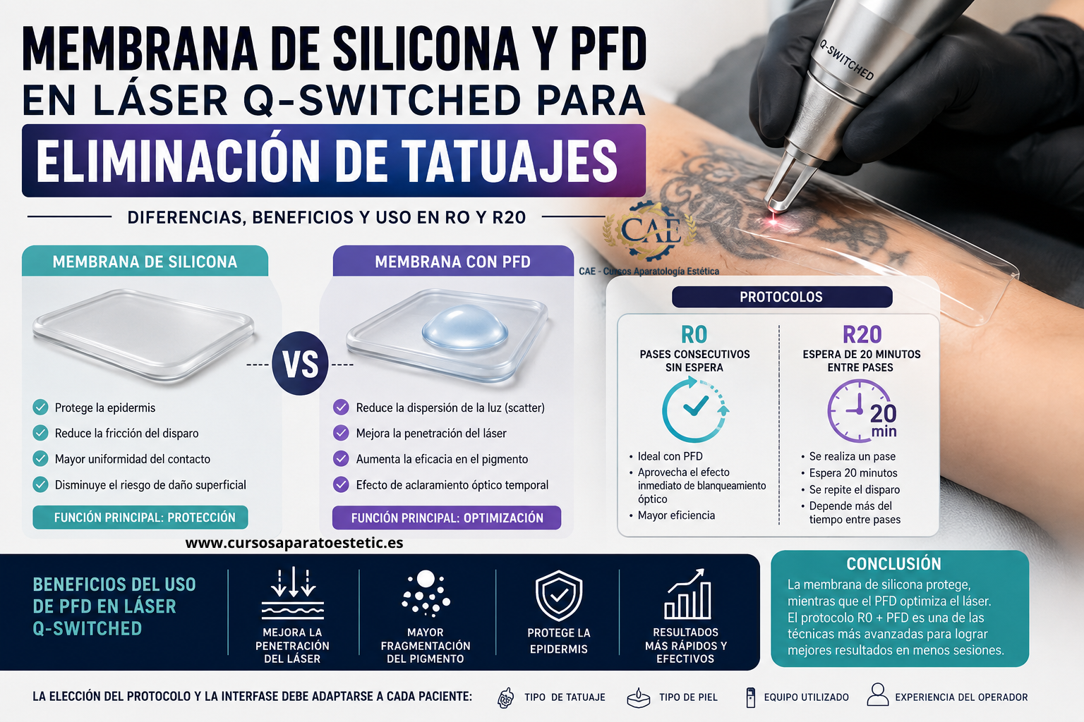 🧴 Membrana de silicona y PFD en láser Q-Switched para eliminación de tatuajes (R0 y R20)