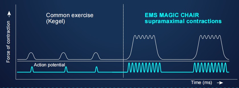 como funciona smart pelvic pro