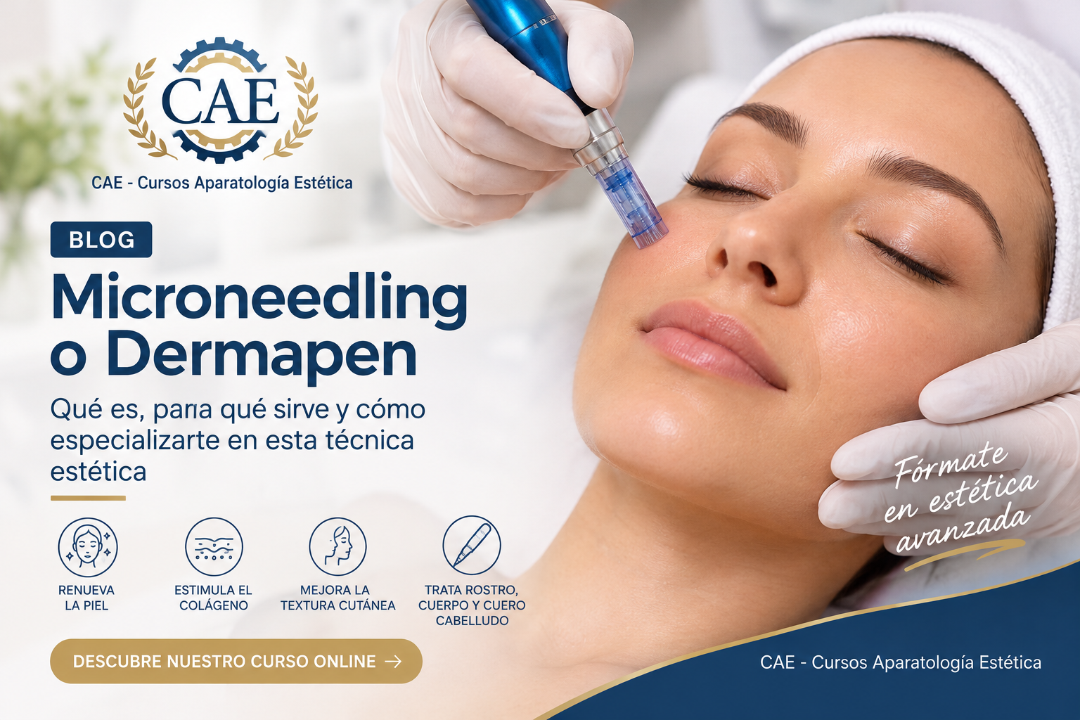 Microneedling o Dermapen: qué es y cómo formarte