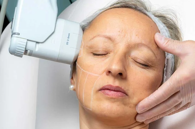 Mujer recibiendo un tratamiento facial con un dispositivo estético en una clínica.